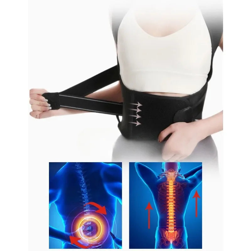 Back Support Hunchback Correction Belt Posture Corrector Comfortable Adjustable Unisex Spine Shoulder Lumbar Posture Correction