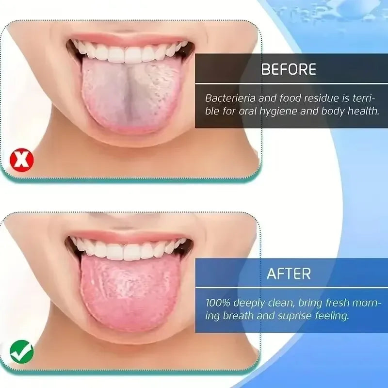 Travel Portable Tongue Scraper, Oral Hygiene Kit, Companion to Toothbrush, Compact & Hygienic Case Included